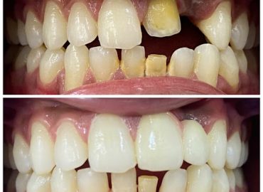The Dental Park – Dr Madhuri S Shinde