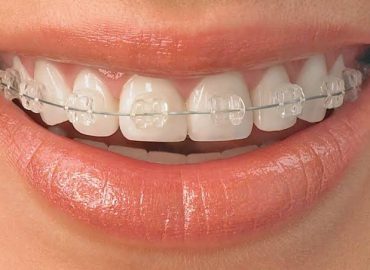BALAJI DENTAL AND BRACES CLINIC