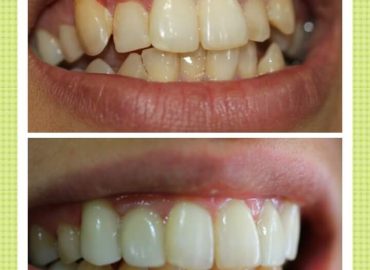 Dr. Leena Nayak’s Dental Care Clinic in Panvel